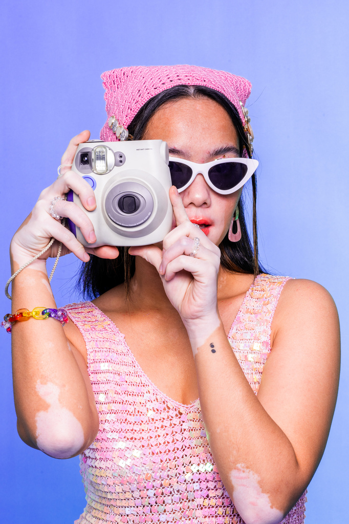 Stylish Woman with Vitiligo Using an Instant Camera 